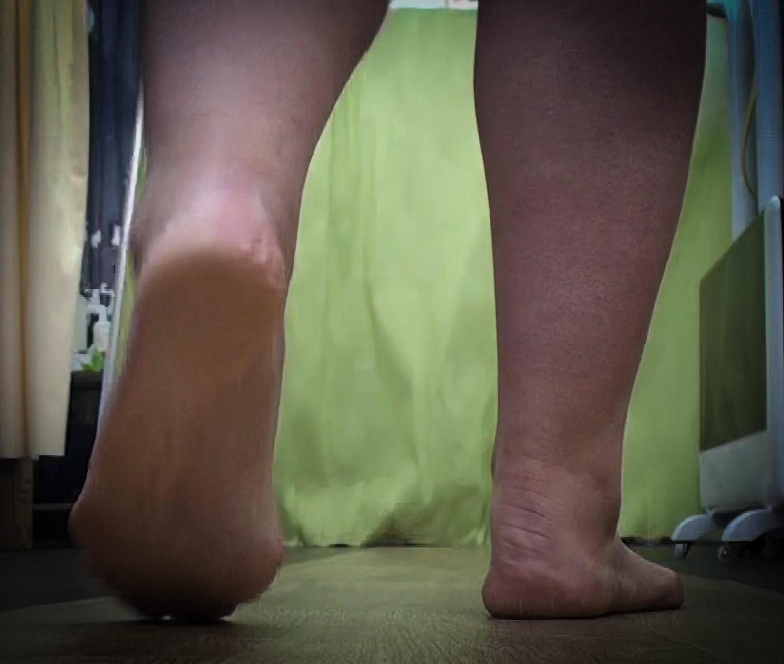 外反母趾や足の無料相談会