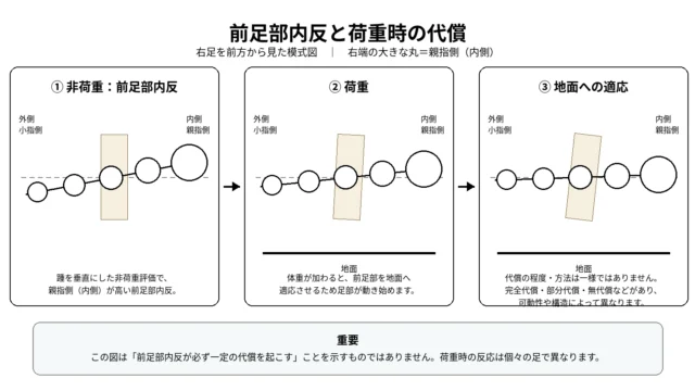 画像②:前足部内反と荷重時の代償を示す図