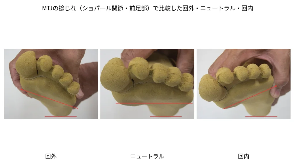 MTJの捻じれ(ショパール関節・前足部)で比較した回外・ニュートラル・回内